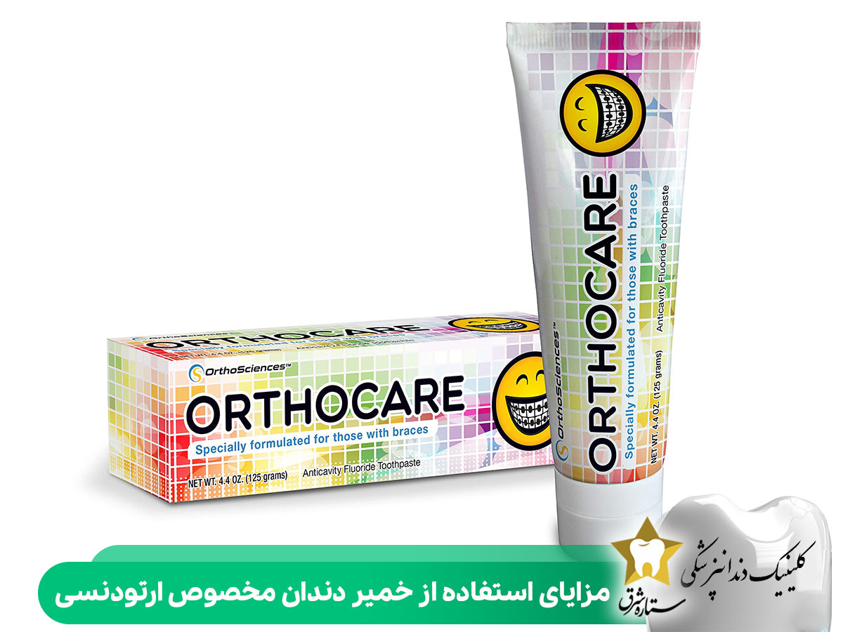 مزایای استفاده از خمیر دندان مخصوص ارتودنسی