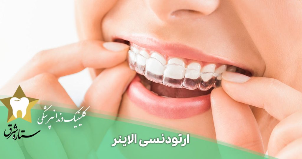 ارتودنسی الاینر
