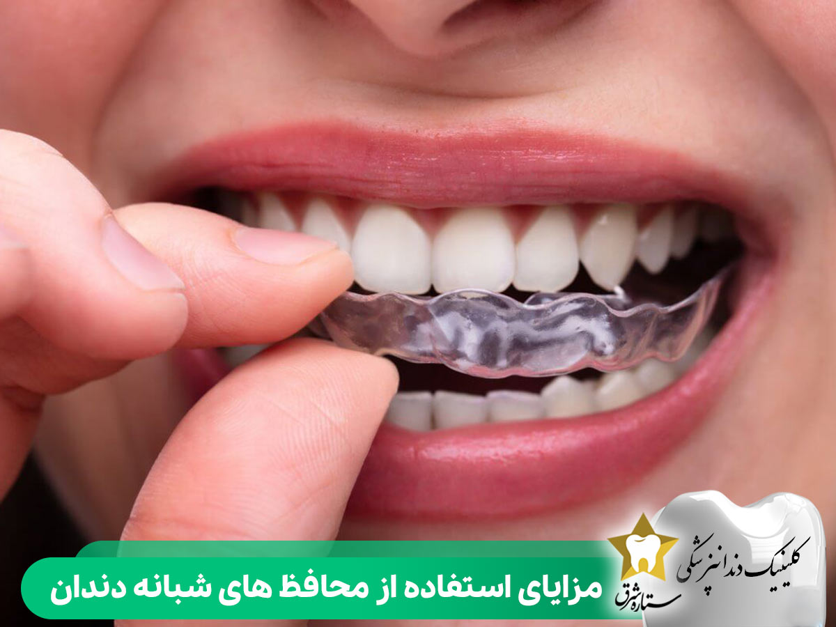 مزایای استفاده از محافظ های شبانه دندان