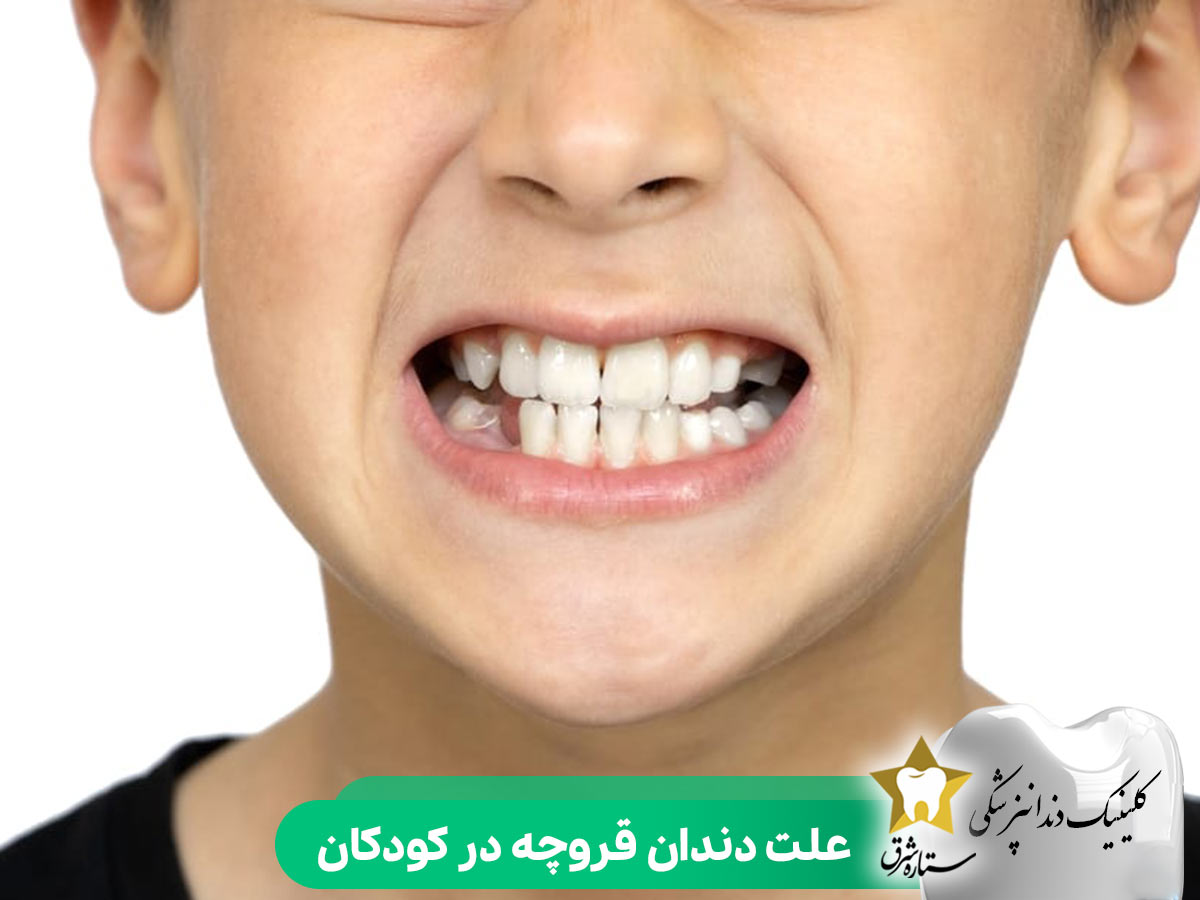 علت دندان قروچه در کودکان