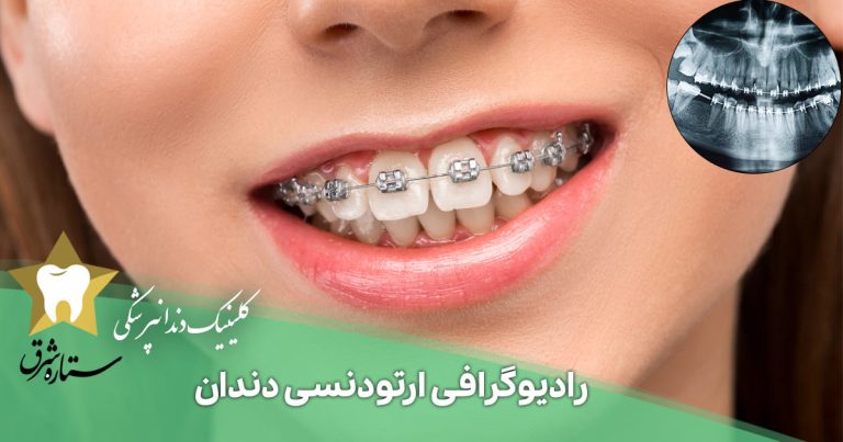 رادیوگرافی ارتودنسی دندان