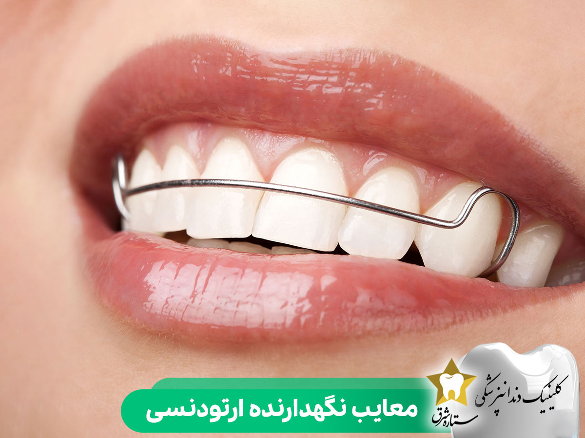 معایب نگهدارنده ارتودنسی