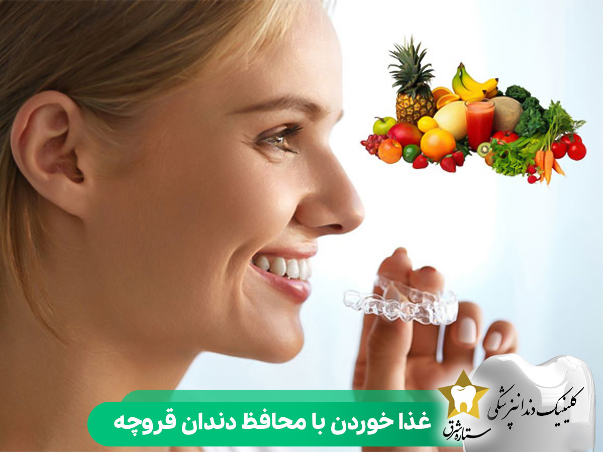 غذا خوردن با محافظ دندان قروچه