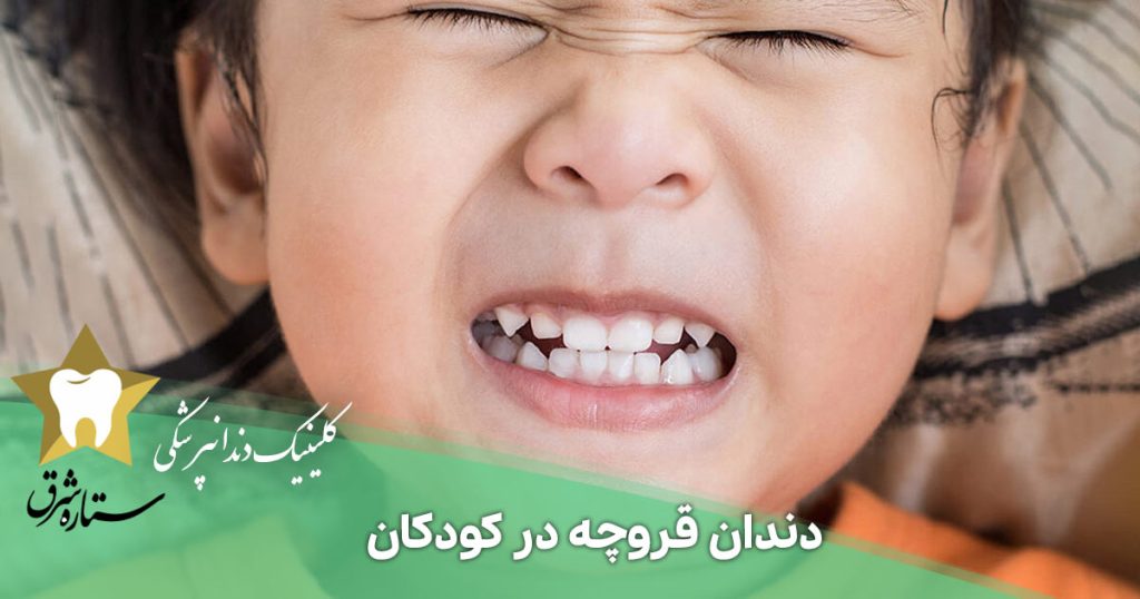 دندان قروچه در کودکان