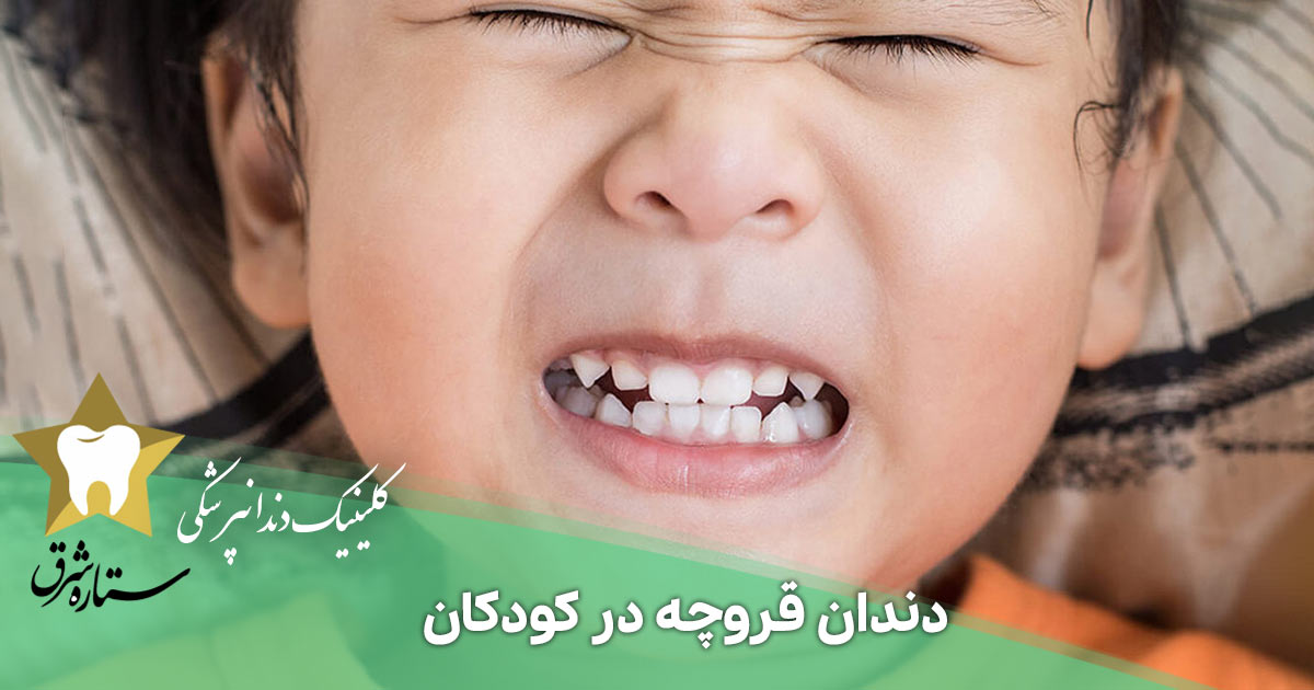 دندان قروچه در کودکان