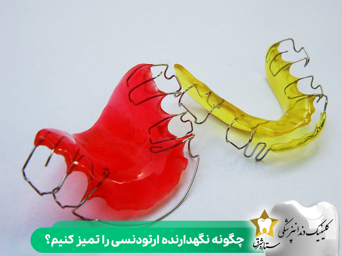 چگونه نگهدارنده ارتودنسی را تمیز کنیم؟