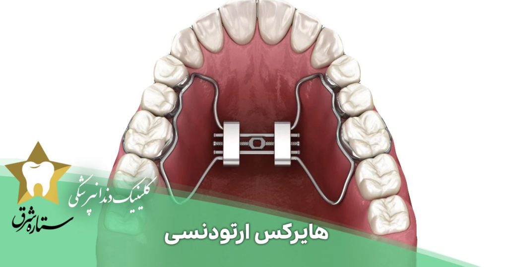 هایرکس ارتودنسی