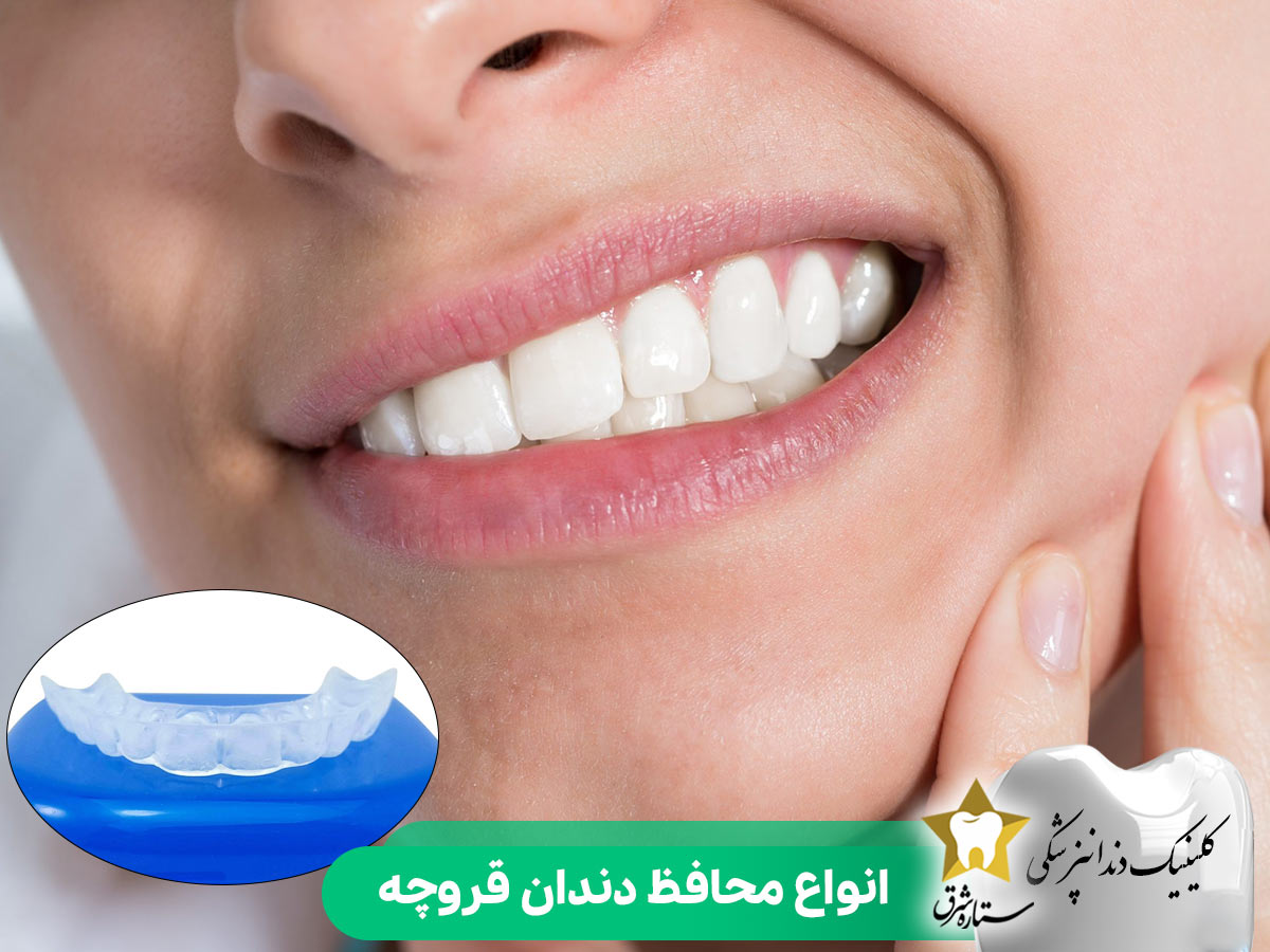 انواع محافظ دندان قروچه