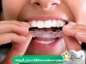 موارد استفاده محافظ‌ دندان قروچه