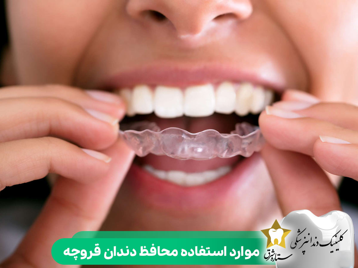 موارد استفاده محافظ دندان قروچه