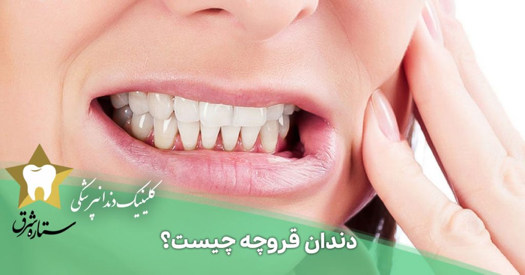 دندان قروچه چیست؟