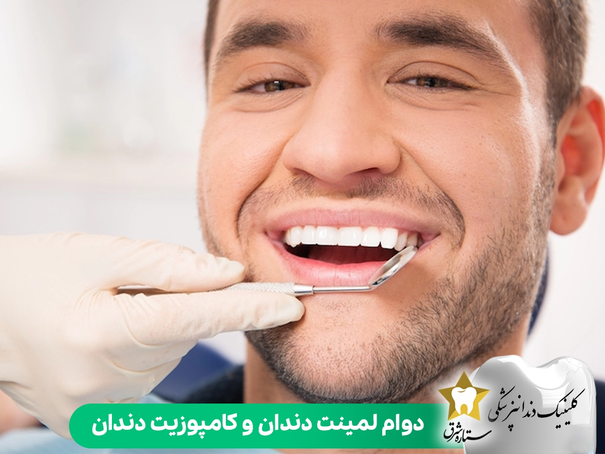 دوام لمینت دندان و کامپوزیت دندان