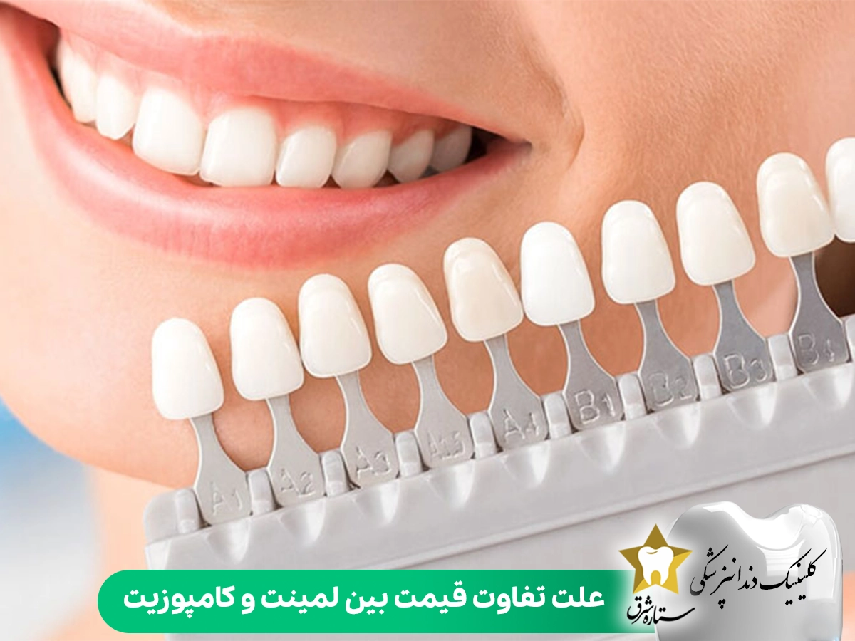 علت تفاوت قیمت بین لمینت و کامپوزیت