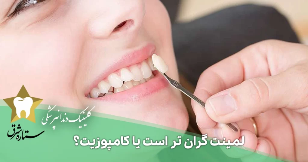 لمینت گران‌تر است یا کامپوزیت؟