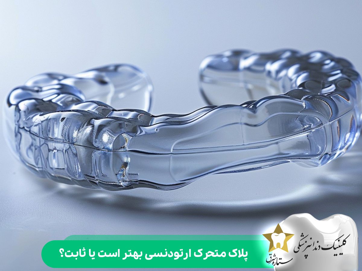 پلاک متحرک ارتودنسی بهتر است یا پلاک ثابت؟