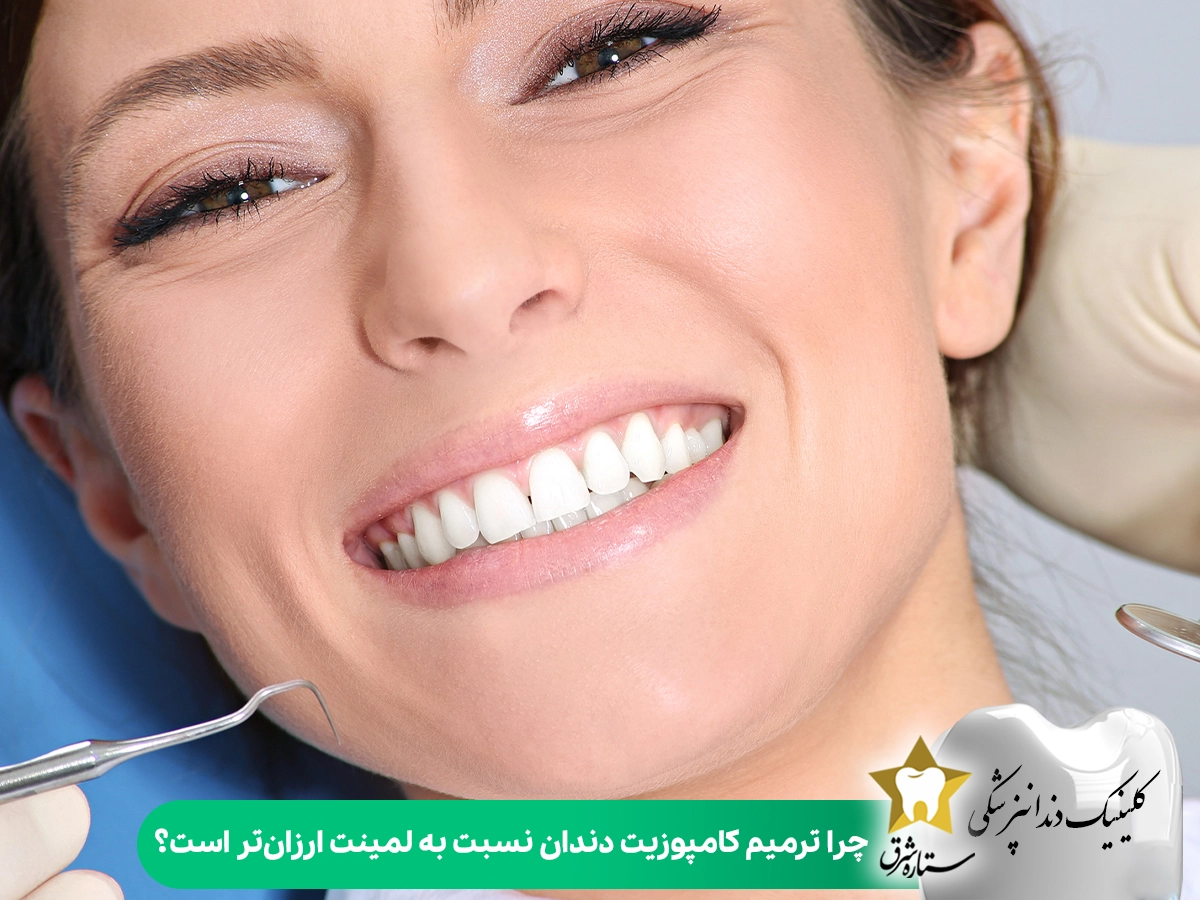 چرا ترمیم کامپوزیت دندان نسبت به لمینت ونیر ارزان‌تر است؟