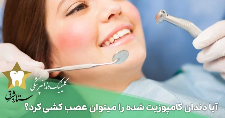 آیا دندان کامپوزیت شده را می‌توان عصب کشی کرد؟