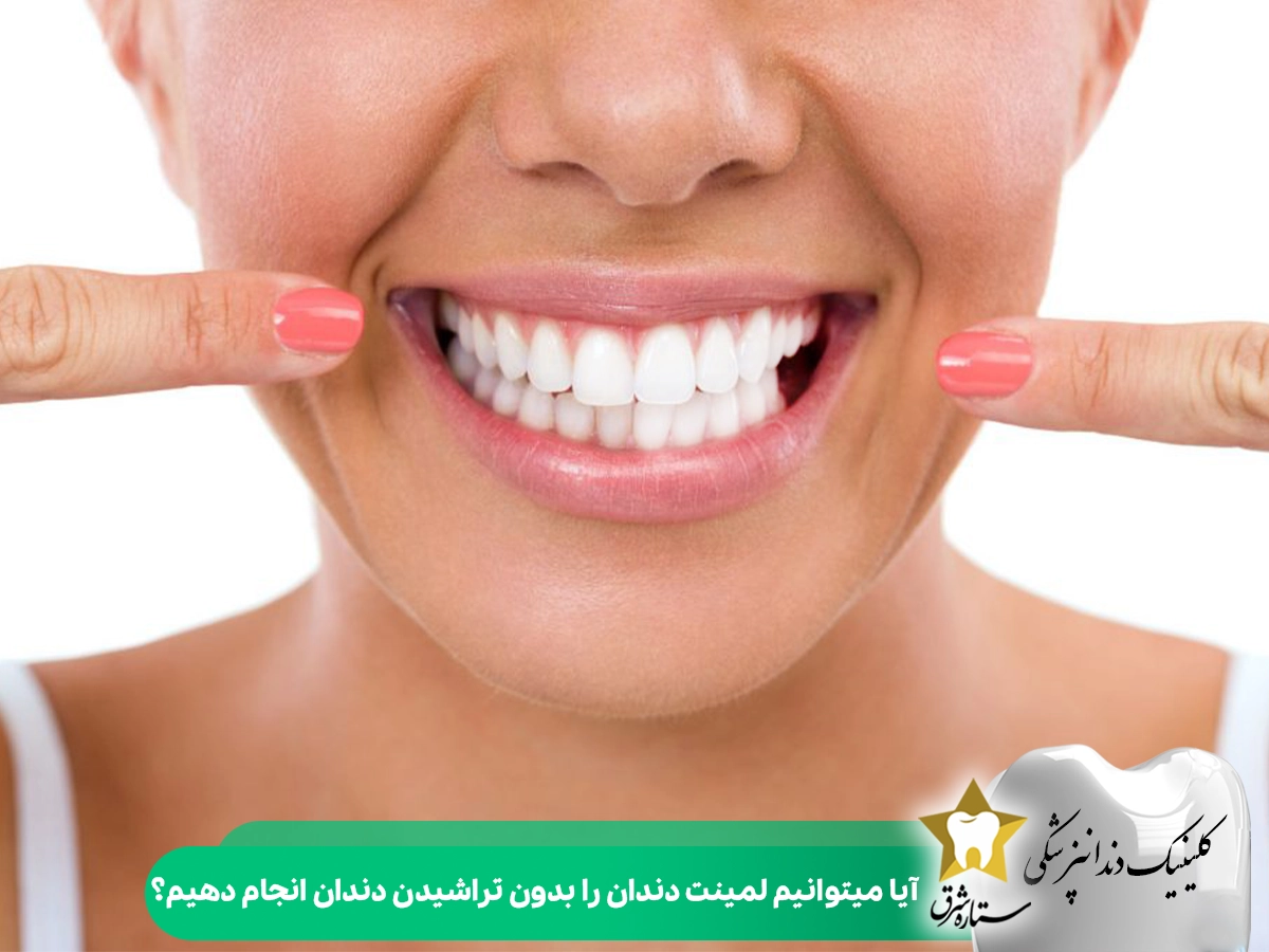 آیا میتوانیم لمینت دندان را بدون تراشیدن دندان انجام دهیم؟