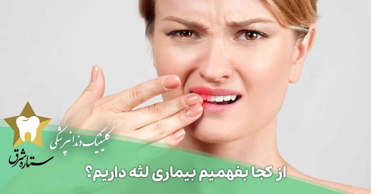 از کجا بفهمیم بیماری لثه داریم؟