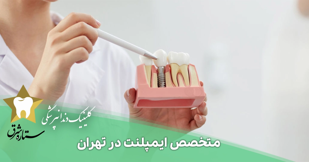 بهترین متخصص ایمپلنت در تهران