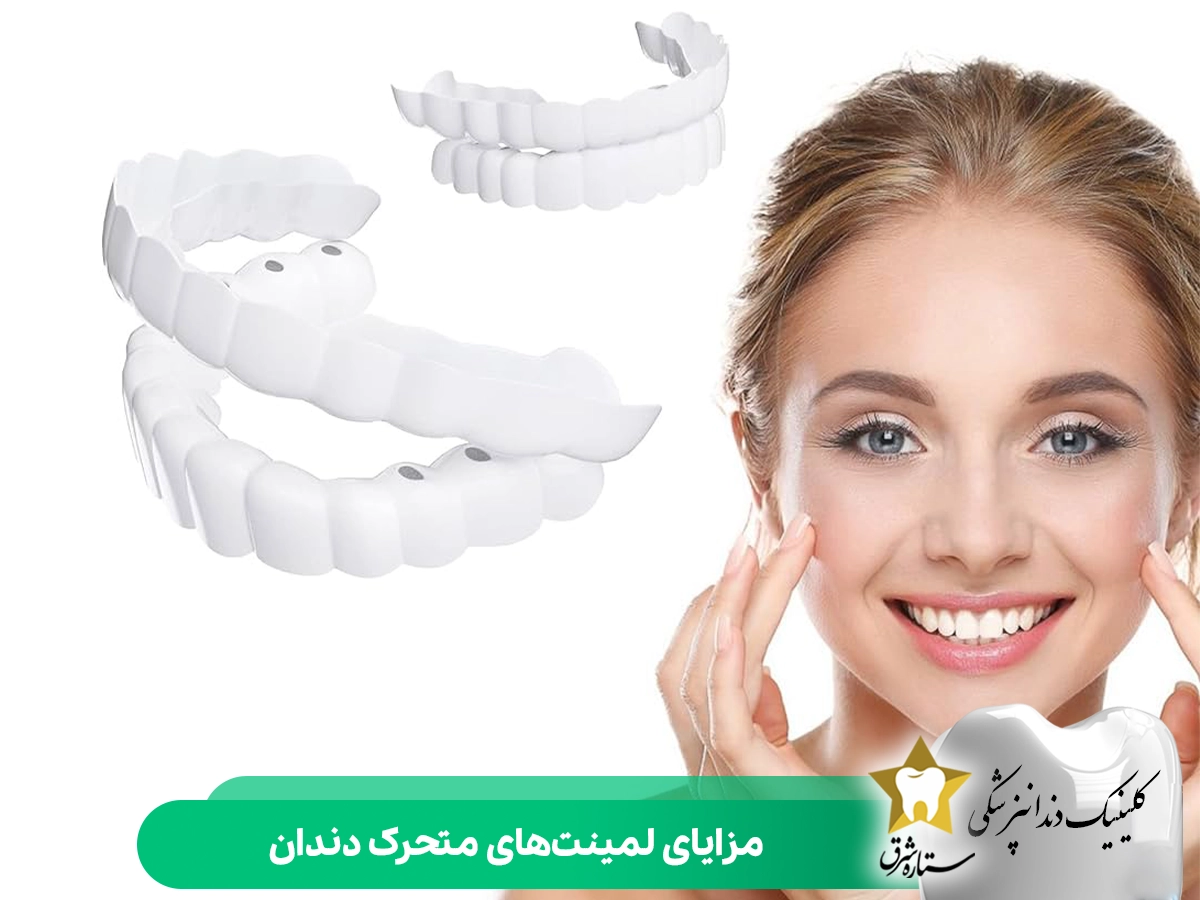 مزایای لمینت متحرک دندان