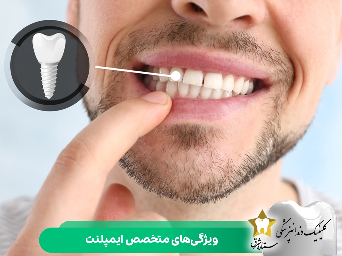 ویژگی_های متخصص ایمپلنت