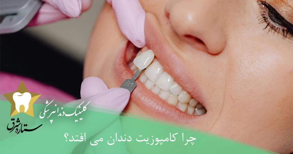 چرا کامپوزیت دندان می افتد؟