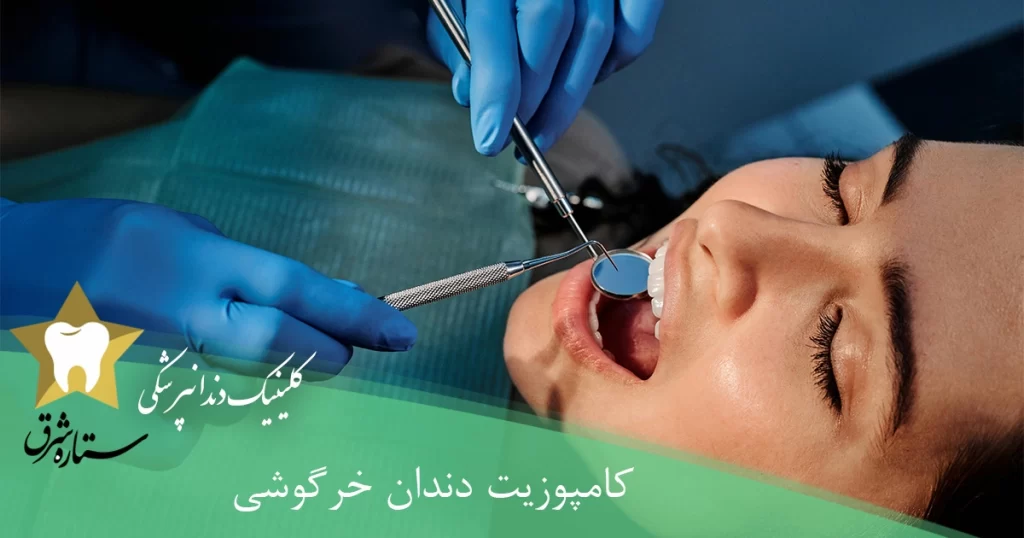 کامپوزیت دندان خرگوشی