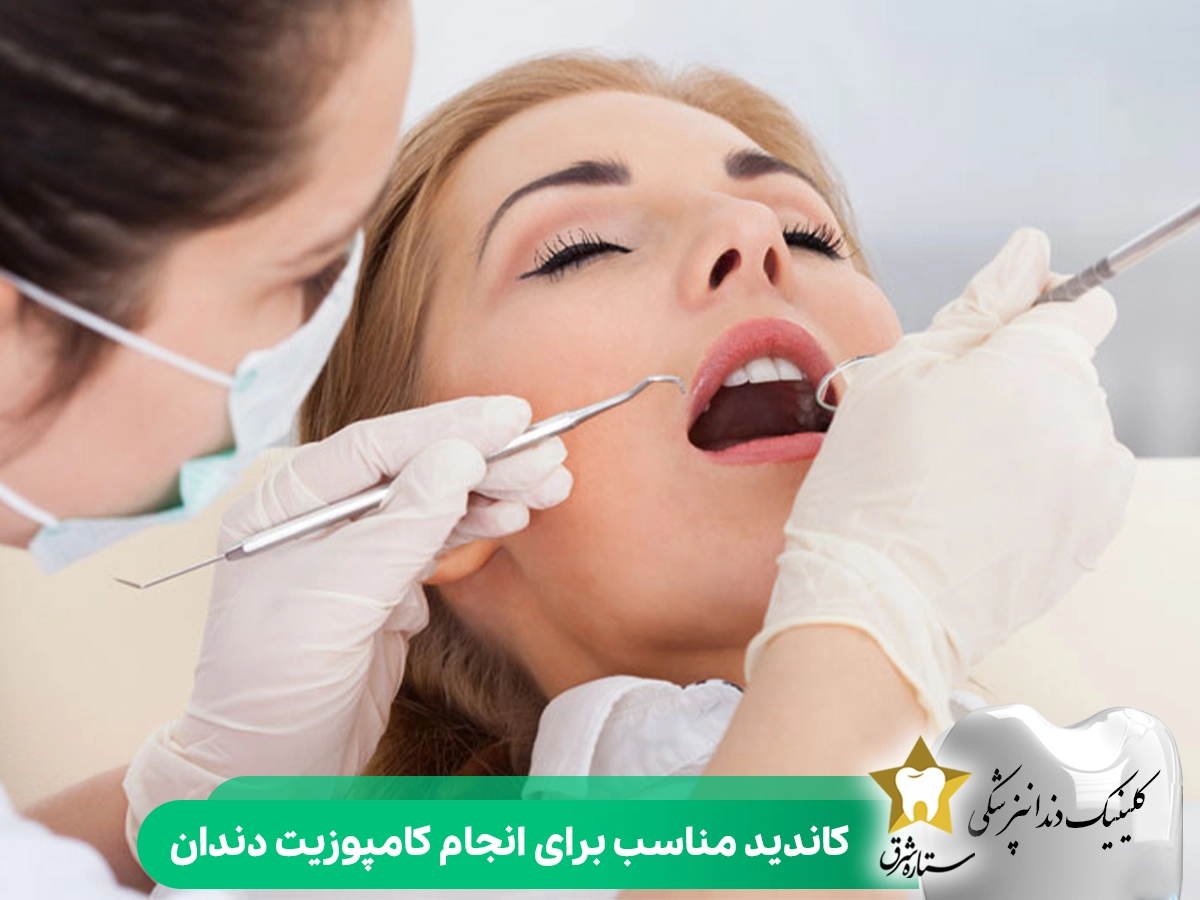 کاندید مناسب برای انجام کامپوزیت دندان