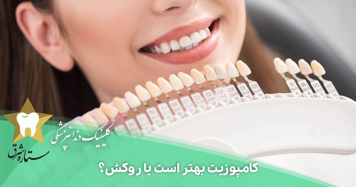 کامپوزیت بهتر است یا روکش؟