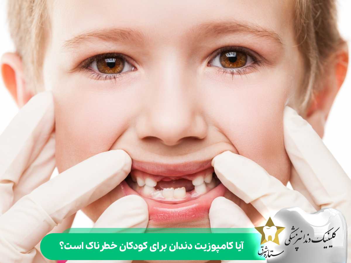 آیا کامپوزیت دندان برای کودکان خطرناک است؟