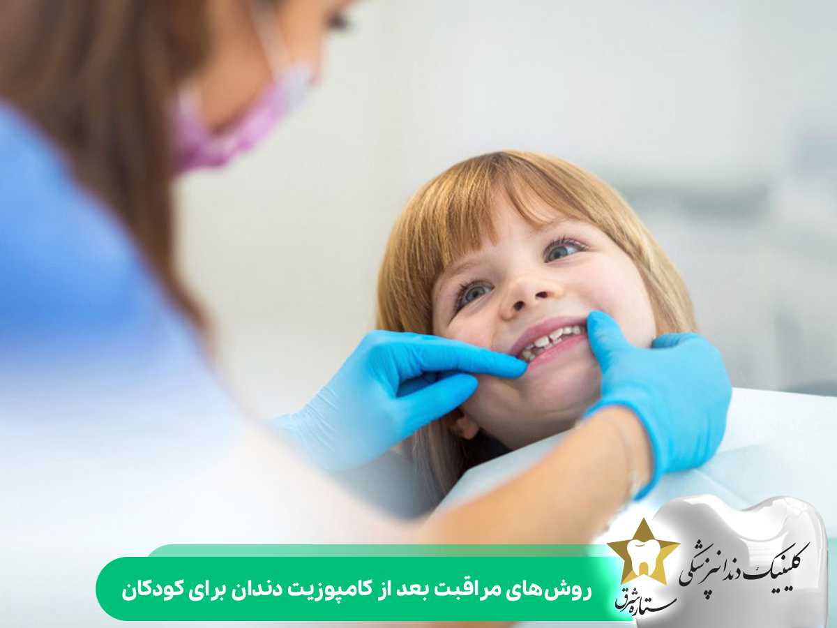 روش‌های مراقبت بعد از کامپوزیت دندان برای کودکان