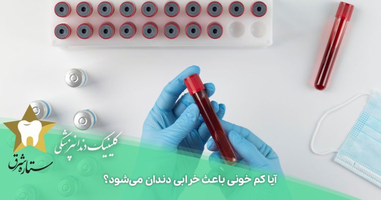 آیا کم خونی باعث خرابی دندان می‌شود؟