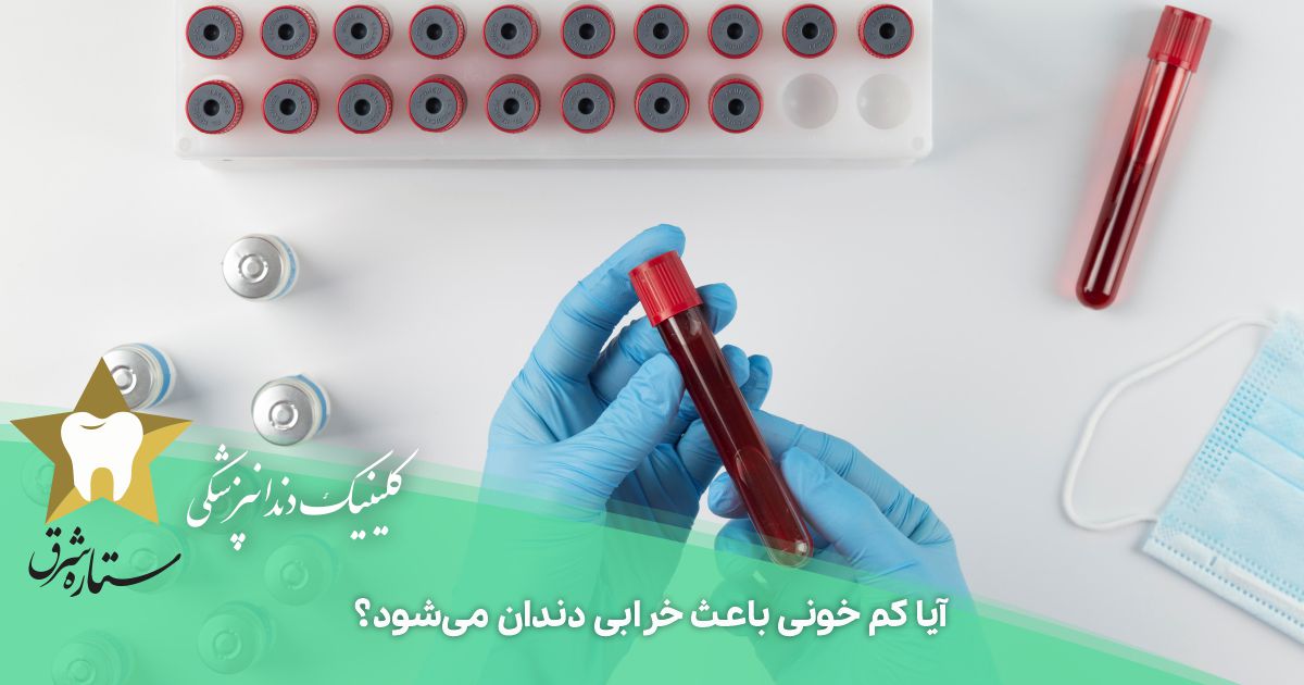 آیا کم خونی باعث خرابی دندان می‌شود؟