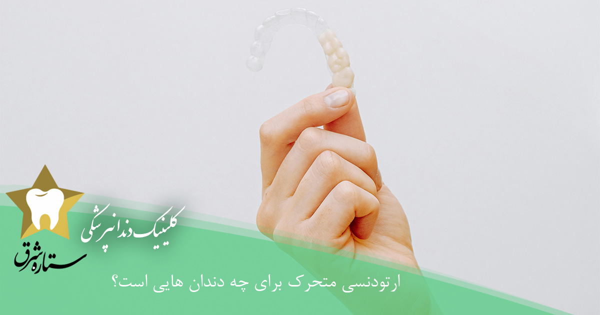 ارتودنسی متحرک برای چه دندان هایی است؟