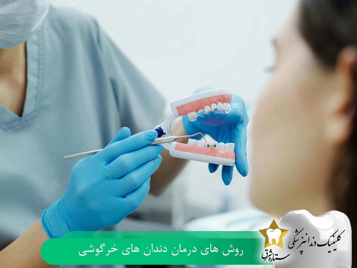 روشهای درمان دندان خرگوشی