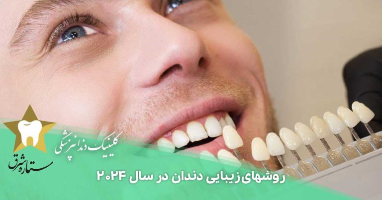 بهترین روش زیبایی دندان ۲۰۲۴