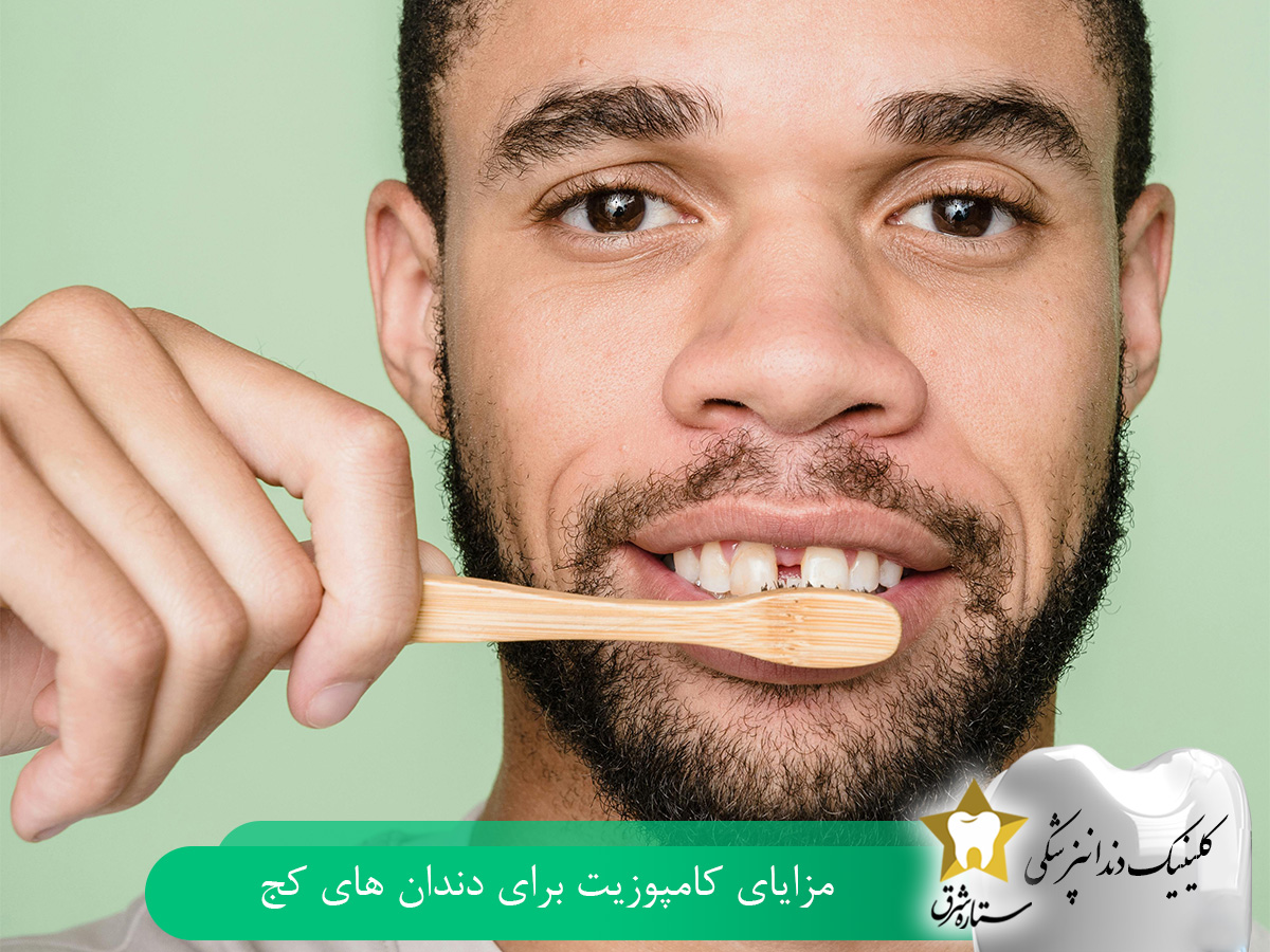 مزایای کامپوزیت دندان کج