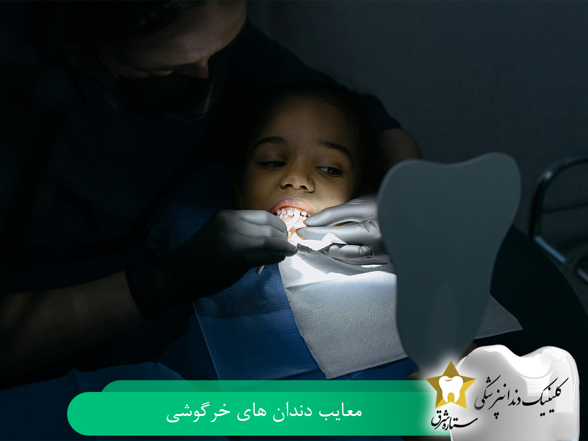 معایب دندانهای خرگوشی