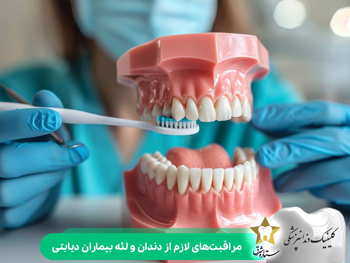 مراقبت‌های لازم از دندان و لثه بیماران دیابتی