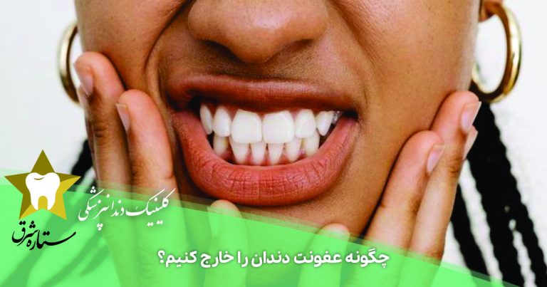 چگونه عفونت دندان را خارج کنیم؟