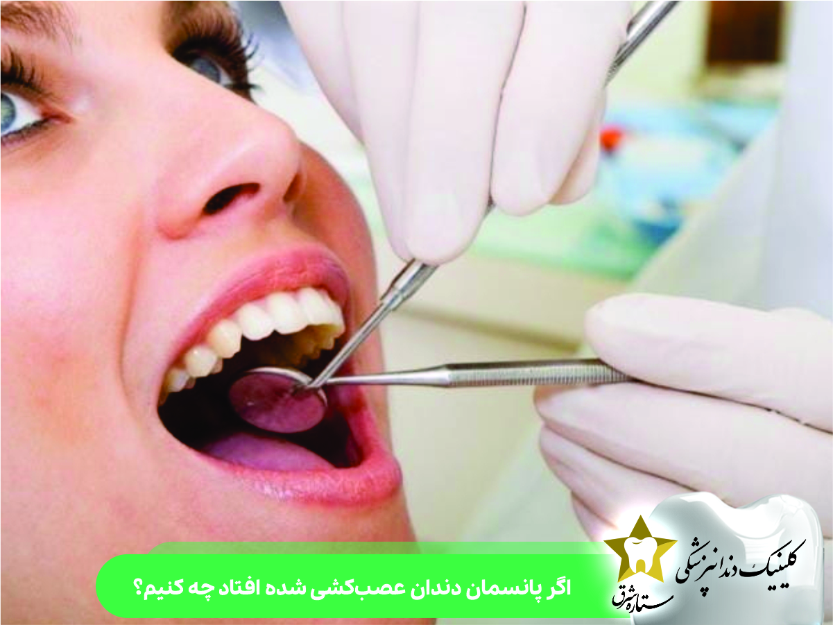 اگر پانسمان دندان عصبکشی شده افتاد چه کنیم؟