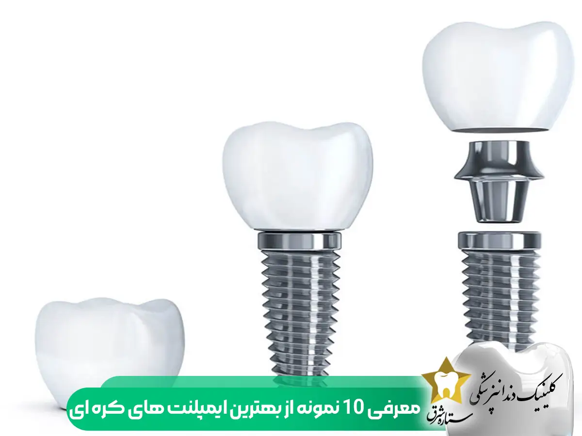 معرفی ۱۰ ایمپلنت کره ای