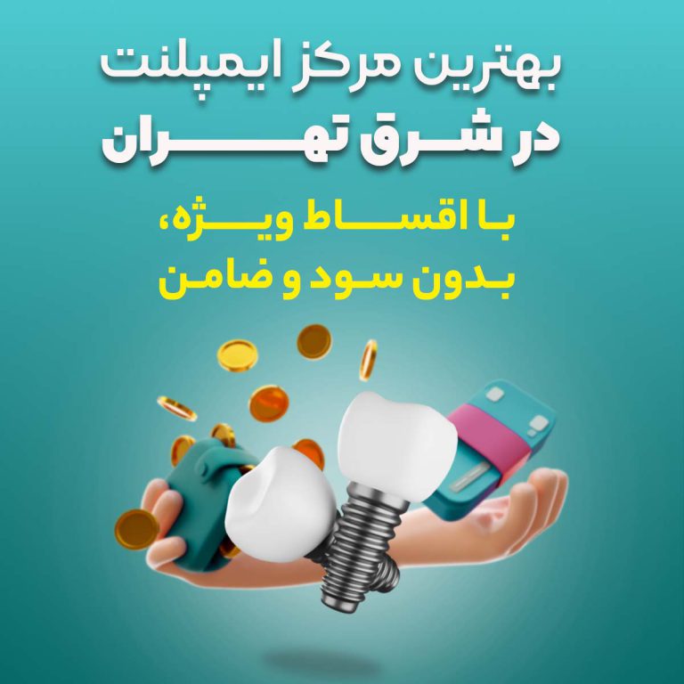 ایمپلنت قسطی در تهران
