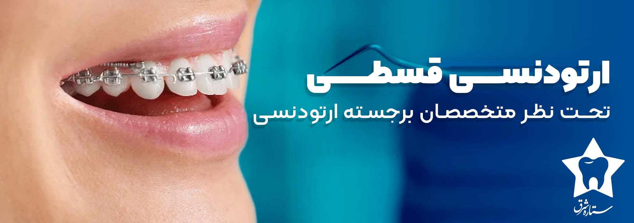 ارتودنسی قسطی
