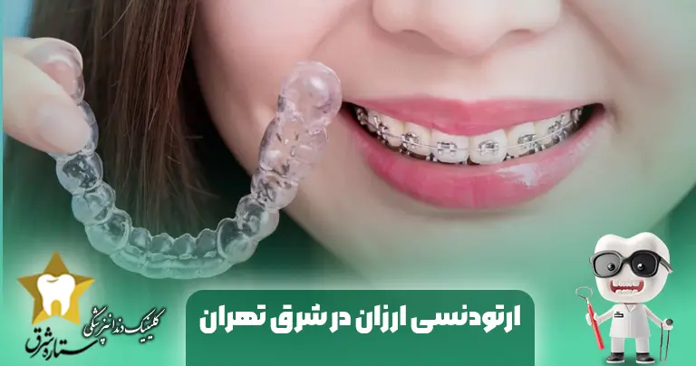 ارتودنسی ارزان در شرق تهران