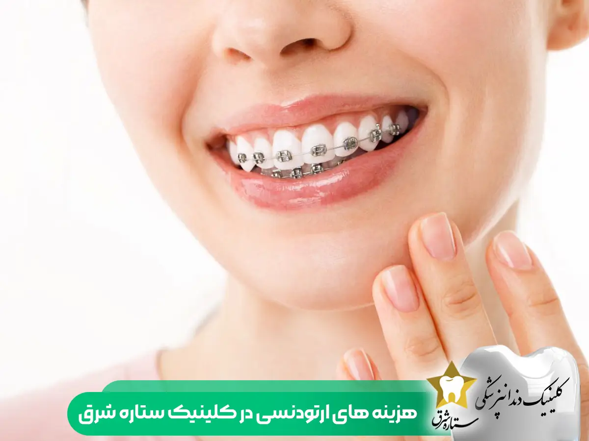 هزینه های ارتودنسی در کلینیک شرق تهران