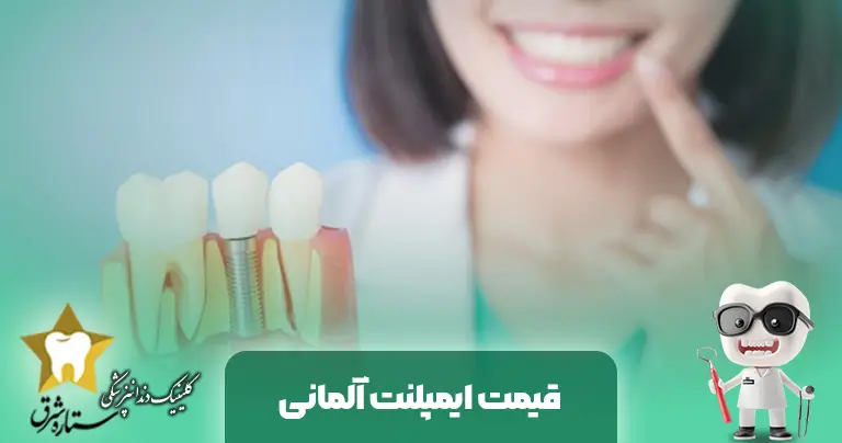 بررسی قیمت ایمپلنت آلمانی با روکش و قیمت ایمپلنت آلمانی bio3