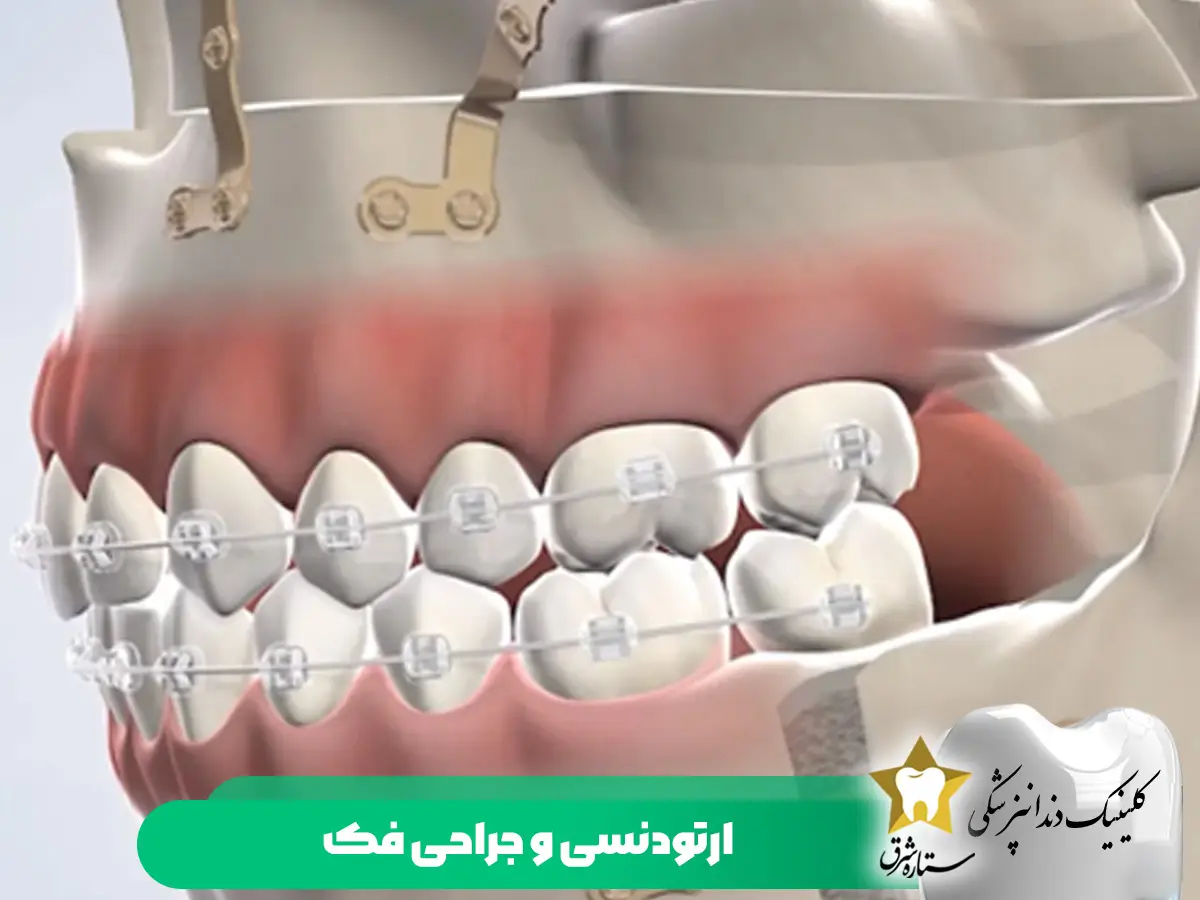 ارتودنسی و جراحی فک