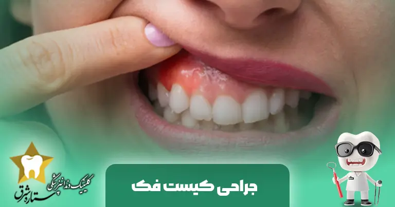 جراحی کیست فک